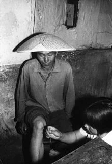 220px Chinese barefoot doctor performing acupuncture